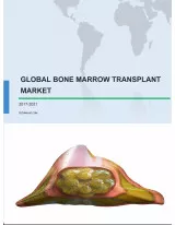 Global Bone Marrow Transplant Market 2017-2021